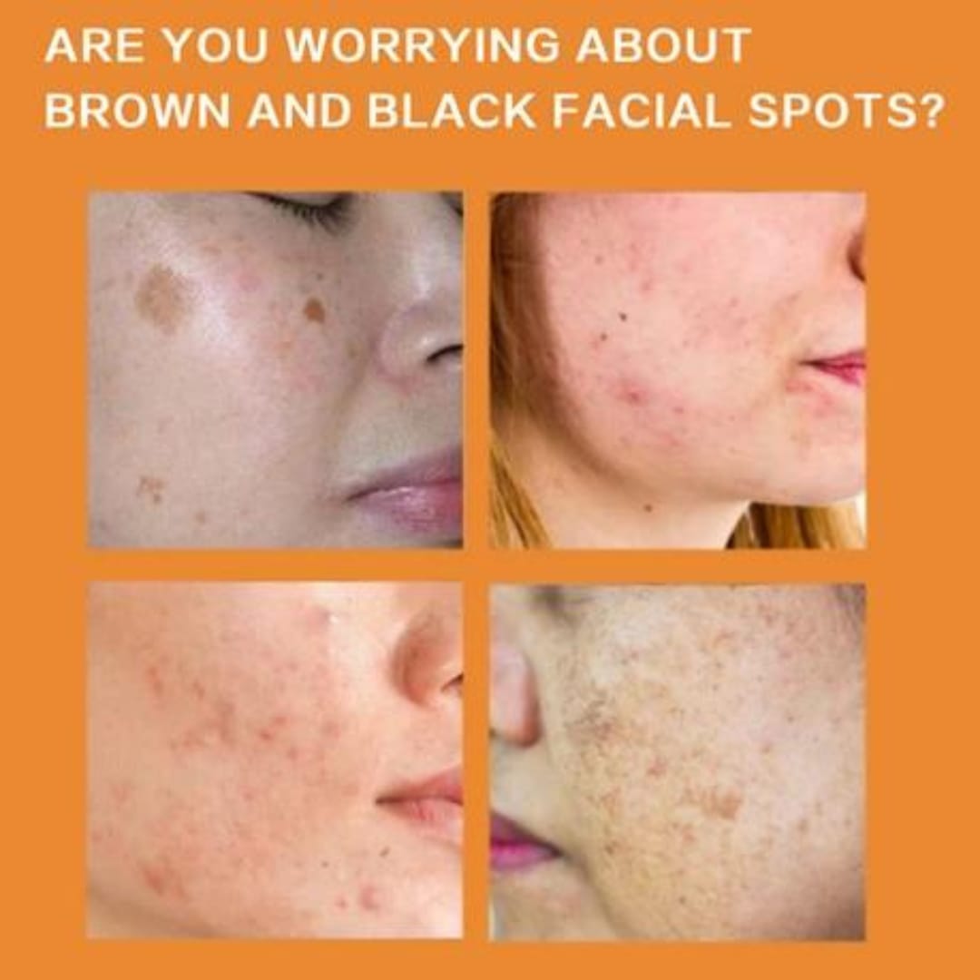 WhatsApp Image 2023-12-21 at 3.58.40 PM (2)